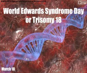 пазл Всемирный день синдрома Эдвардса или трисомия 18
